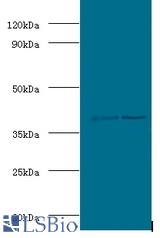 Western blot of Alcohol dehydrogenase class-3 antibody at 2 ug/ml lane 1: mouse liver tissue lane 2: mouse kidney tissue Secondary.