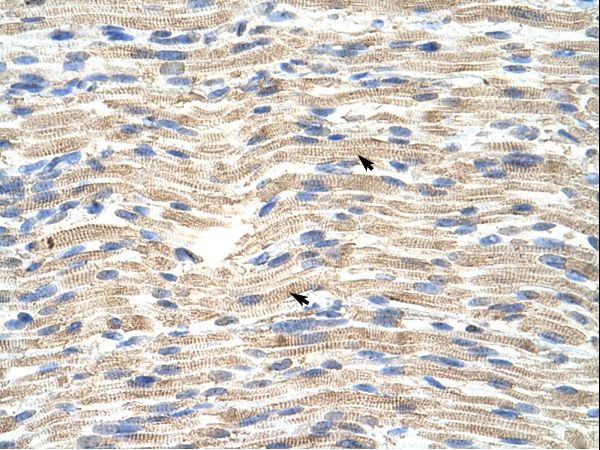 CDKN2AIP antibody LS-C31296 was used in IHC to stain formalin-fixed, paraffin-embedded human muscle.