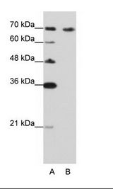 A: Marker, B: Jurkat Cell Lysate