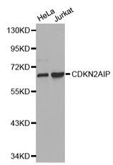 Western blot analysis of extracts of various cell lines, using CDKN2AIP antibody.
