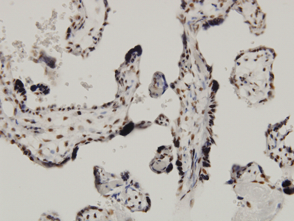Immunoperoxidase of monoclonal antibody to CARF on formalin-fixed paraffin-embedded human placenta. [antibody concentration 3 ug/ml]