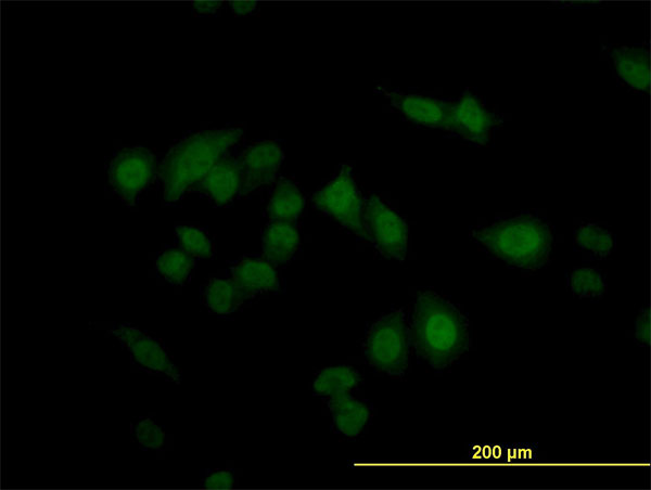 Immunofluorescence of monoclonal antibody to CARF on HeLa cell. [antibody concentration 10 ug/ml]