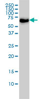 CARF monoclonal antibody (M02), clone 1A6 Western blot of CARF expression in HeLa NE.