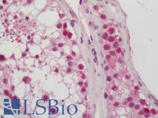 Human Testis: Formalin-Fixed, Paraffin-Embedded (FFPE)