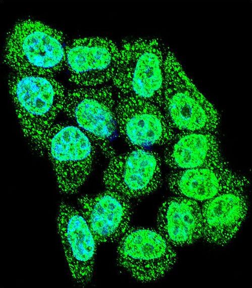 Confocal immunofluorescent of CDKN2B Antibody with HeLa cell followed by Alexa Fluor 488-conjugated goat anti-rabbit lgG (green). DAPI was used to stain the cell nuclear (blue).