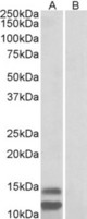 CDKN2B antibody (1 ug/ml) staining of Human Gastrointestinal cancer lysate (35 ug protein in RIPA buffer) with (B) and without (A) blocking with the immunizing peptide. Primary incubation was 1 hour. Detected by chemiluminescence.