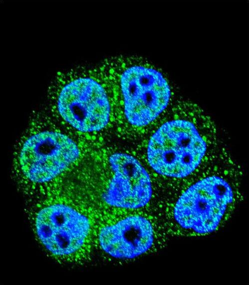 Confocal immunofluorescent of CDKN2B Antibody with HeLa cell followed by Alexa Fluor 488-conjugated goat anti-rabbit lgG (green). DAPI was used to stain the cell nuclear (blue).