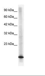 HepG2 Cell Lysate