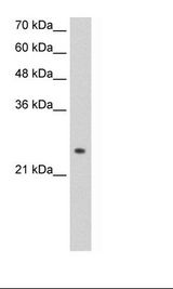 HepG2 Cell Lysate
