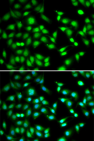 Immunofluorescence blot of HeLa cell using CDKN2D antibody. Blue: DAPI for nuclear staining.