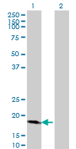Western Blot analysis of CDKN2D expression in transfected 293T cell line by CDKN2D monoclonal antibody (M08), clone 2E10.Lane 1: CDKN2D transfected lysate(17.7 KDa).Lane 2: Non-transfected lysate.