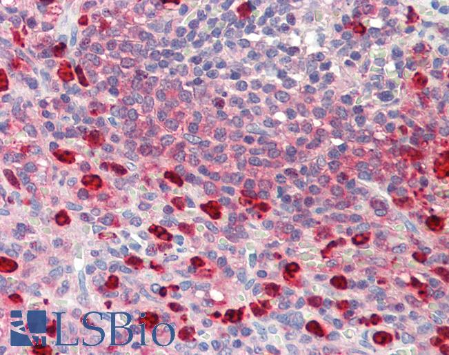 Anti-CDKN2D / p19 INK4d antibody IHC staining of human spleen. Immunohistochemistry of formalin-fixed, paraffin-embedded tissue after heat-induced antigen retrieval.