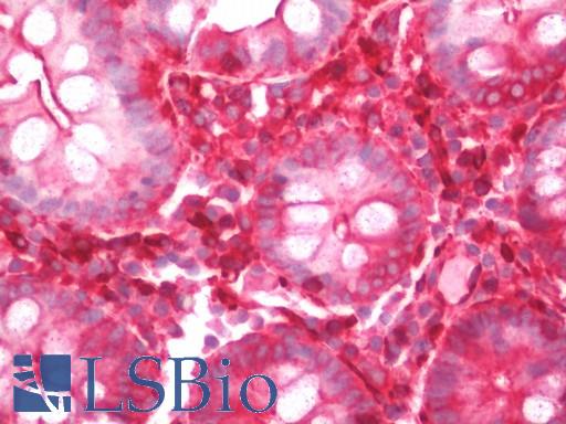 Human Colon: Formalin-Fixed, Paraffin-Embedded (FFPE)