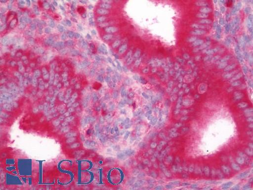 Human Uterus, Endometrium: Formalin-Fixed, Paraffin-Embedded (FFPE)