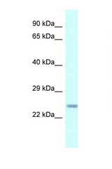 CDKN3 antibody LS-C145708 Western blot of Mouse Heart lysate. Antibody concentration 1 ug/ml.