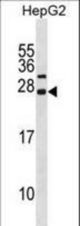 CDKN3 Antibody western blot of HepG2 cell line lysates (35 ug/lane). The CDKN3 antibody detected the CDKN3 protein (arrow).