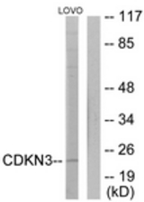 Western blot of extracts from LOVO cells, using CDKN3 Antibody. The lane on the right was incubated with synthetic peptide.