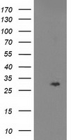 HEK293T cells were transfected with the pCMV6-ENTRY control (Left lane) or pCMV6-ENTRY CDKN3 (Right lane) cDNA for 48 hrs and lysed. Equivalent amounts of cell lysates (5 ug per lane) were separated by SDS-PAGE and immunoblotted with anti-CDKN3.
