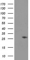 HEK293T cells were transfected with the pCMV6-ENTRY control (Left lane) or pCMV6-ENTRY CDKN3 (Right lane) cDNA for 48 hrs and lysed. Equivalent amounts of cell lysates (5 ug per lane) were separated by SDS-PAGE and immunoblotted with anti-CDKN3.
