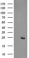 HEK293T cells were transfected with the pCMV6-ENTRY control (Left lane) or pCMV6-ENTRY CDKN3 (Right lane) cDNA for 48 hrs and lysed. Equivalent amounts of cell lysates (5 ug per lane) were separated by SDS-PAGE and immunoblotted with anti-CDKN3.