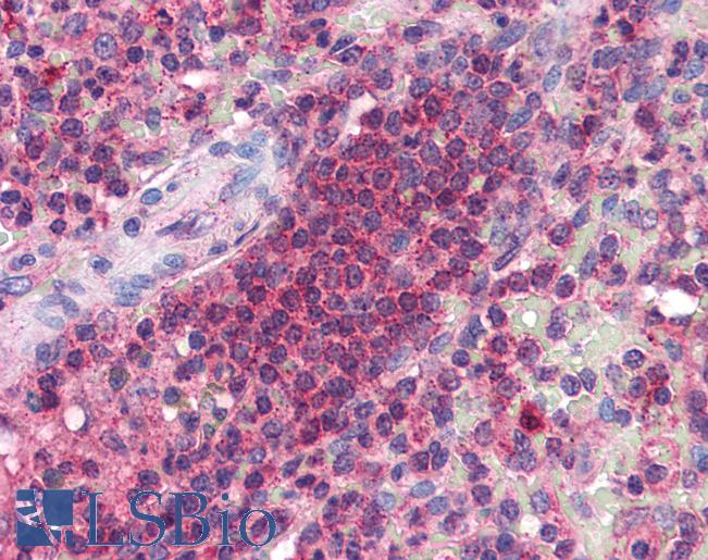 Anti-CDNF / ARMETL1 antibody IHC of human spleen. Immunohistochemistry of formalin-fixed, paraffin-embedded tissue after heat-induced antigen retrieval. Antibody LS-B2731 concentration 5 ug/ml.