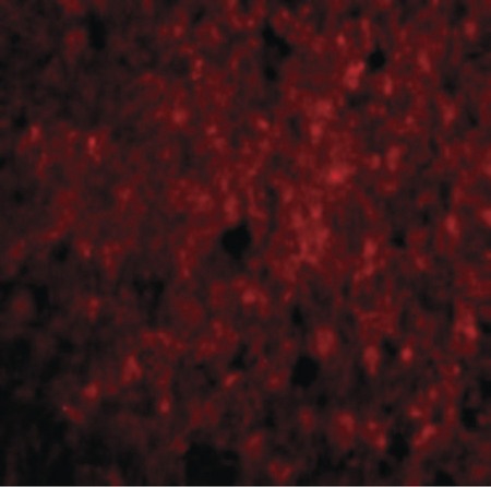 Immunofluorescence of CDNF in Human Brain cells with CDNF antibody at 20 ug/ml.