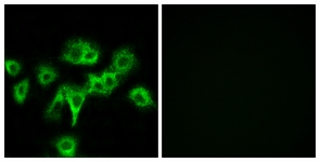 Immunofluorescence of HeLa cells, using CDON Antibody. The picture on the right is treated with the synthesized peptide.