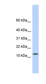 CDRT4 antibody LS-C111677 Western blot of Fetal Heart lysate.