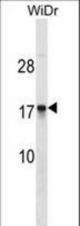 CDRT4 Antibody western blot of WiDr cell line lysates (35 ug/lane). The CDRT4 Antibody detected the CDRT4 protein (arrow).