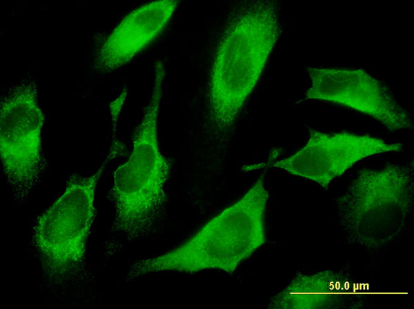 Immunofluorescence of monoclonal antibody to CDS1 on HeLa cell . [antibody concentration 10 ug/ml]
