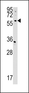CDS2 Antibody western blot of HepG2 cell line lysates (35 ug/lane). The CDS2 antibody detected the CDS2 protein (arrow).