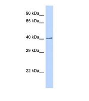 Western blot of Human 293T. CDS2 antibody dilution 1.0 ug/ml.