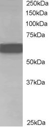 Antibody staining (1 ug/ml) of Human Brain lysate (RIPA buffer, 35 ug total protein per lane). Primary incubated for 1 hour. Detected by Western blot of chemiluminescence.