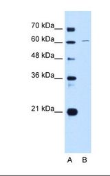 Lane A: Marker. Lane B: HepG2 cell lysate. Antibody concentration: 1.0 ug/ml. Gel concentration: 12%.
