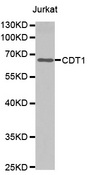 Western blot analysis of extracts of Jurkat cells tissue, using CDT1 antibody.