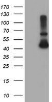 HEK293T cells were transfected with the pCMV6-ENTRY control (Left lane) or pCMV6-ENTRY ADH7 (Right lane) cDNA for 48 hrs and lysed. Equivalent amounts of cell lysates (5 ug per lane) were separated by SDS-PAGE and immunoblotted with anti-ADH7.