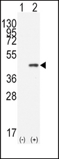 Western blot of CDX2(arrow) using rabbit polyclonal CDX2 Antibody. 293 cell lysates (2 ug/lane) either nontransfected (Lane 1) or transiently transfected with the CDX2 gene (Lane 2) (Origene Technologies).