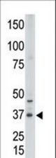 The anti-CDX2 N-term antibody is used in Western blot to detect CDX2 in placenta tissue lysate.