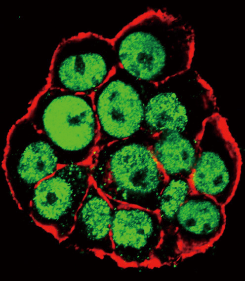Confocal immunofluorescent of Phospho-CDX2-S283 Antibody with WiDr cell followed by Alexa Fluor 488-conjugated goat anti-rabbit lgG (green). Actin filaments have been labeled with Alexa Fluor 555 phalloidin (red).