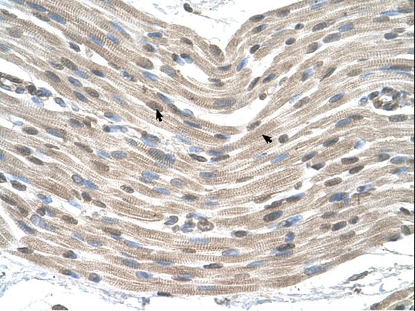 CDX4 antibody LS-C40288 was used in IHC to stain formalin-fixed, paraffin-embedded human muscle.