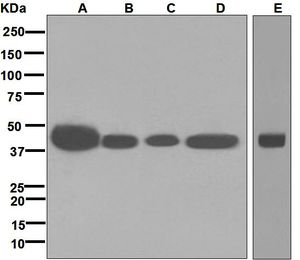 Western blot analysis on (A) C6, (B) RAW264.7, (C) HeLa, (D) HepG2, and (E) fetal brain lysates using anti-CDX4 antibody.