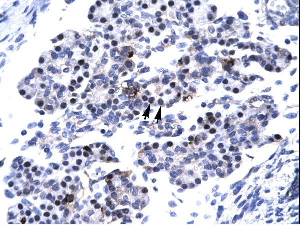 CDX4 antibody LS-C30413 was used in IHC to stain formalin-fixed, paraffin-embedded human pancreas.