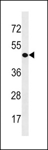 CDY1 Antibody western blot of A549 cell line lysates (35 ug/lane). The CDY1 antibody detected the CDY1 protein (arrow).