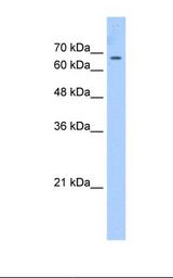 HepG2 cell lysate. Antibody concentration: 2.5 ug/ml. Gel concentration: 12%.
