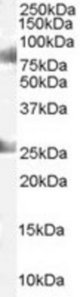 CDYL antibody staining (1 ug/ml) of Human Testes lysate (RIPA buffer, 35g total protein per lane). Primary incubated for 1 hour. Detected by Western blot of chemiluminescence.