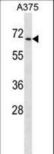 CDYL Antibody western blot of A375 cell line lysates (35 ug/lane). The CDYL antibody detected the CDYL protein (arrow).