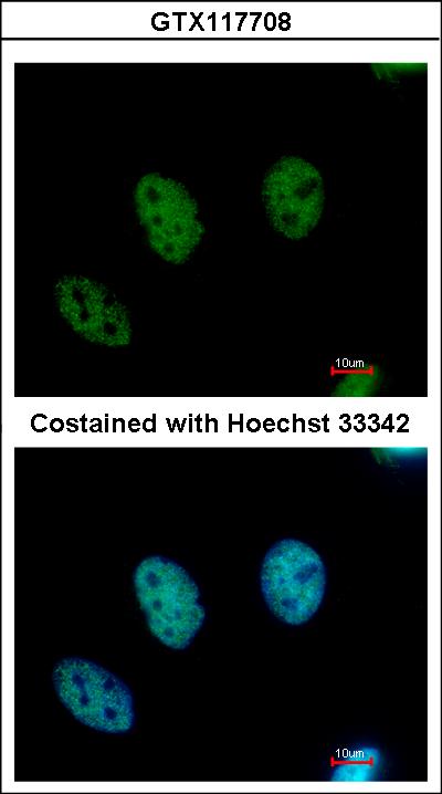 Immunofluorescence of paraformaldehyde-fixed HeLa, using CDYL antibody at 1:500 dilution.