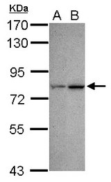 Sample (30 ug of whole cell lysate) A: NT2D1 B: U87-MG 7.5% SDS PAGE CDYL antibody diluted at 1:500