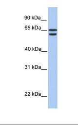 721_B cell lysate. Antibody concentration: 1.0 ug/ml. Gel concentration: 12%.