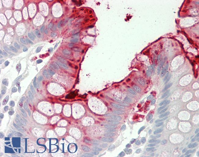 Human Colon: Formalin-Fixed, Paraffin-Embedded (FFPE)